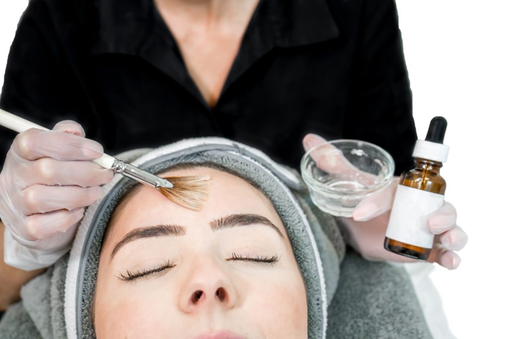 What Are The Benefits Of A Chemical Peel?