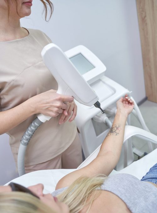 Female adult receiving laser tattoo removal treatment on arm in clinic.